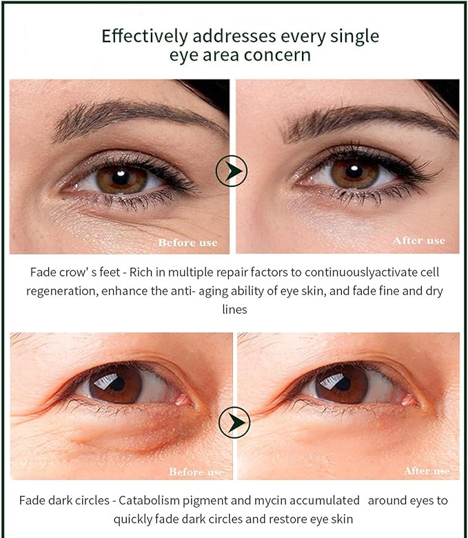 Time Eraser Under Eye Serum — Instantly Fades Dark Circles, Puffiness & Fine Lines | Anti-Aging Roll-On | 1سيروم تايم إيريزر لمنطقة العين — يُخفي الهالات الداكنة والانتفاخ وخطوط التعبير فوراً | رول-أون مضاد للشيخوخة | 10 مل0ml