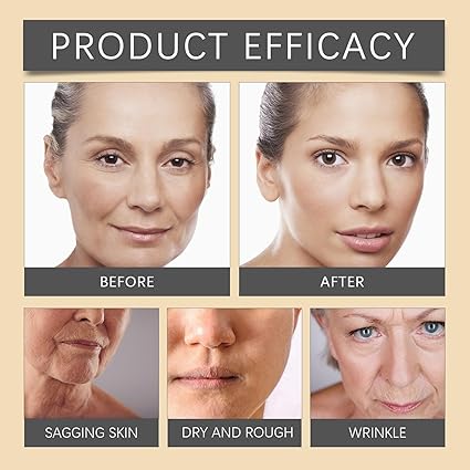 OUHOE Bee Venom Botox Wrinkle Cream — Natural Face Lifting & Anti-Aging Firming Cream | Erase Fine Lines | 20g    كريم OUHOE بوتوكس سم النحل لمكافحة التجاعيد — رفع طبيعي للوجه وشد البشرة | يمحو الخطوط الدقيقة | 20 جرام